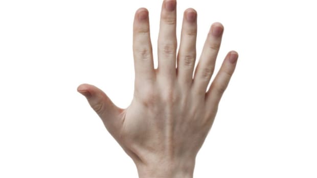 six-finger-hand