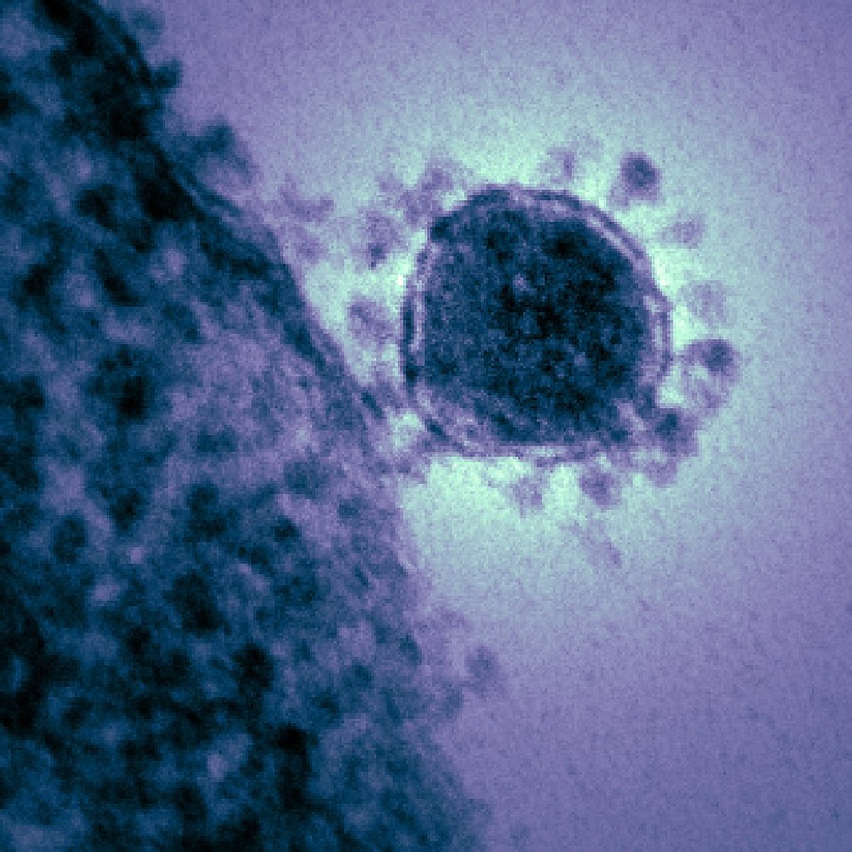 If You're Not Spreading A Deadly Pathogen Around The Globe, You're Just Not Cut Out For Investment Banking - Vimarsana News